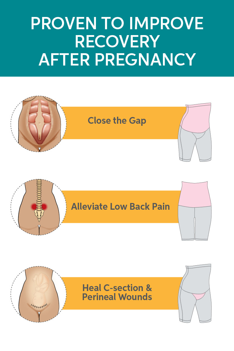 SRC C-Section Recovery Mini Shorts